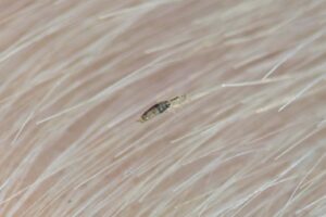 Close up image of head lice in hair